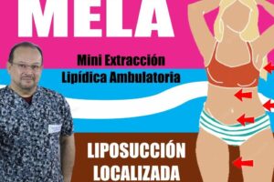 Centro MELA Perú – Mini Extracción Lipídica Ambulatoria en 15 minutos.